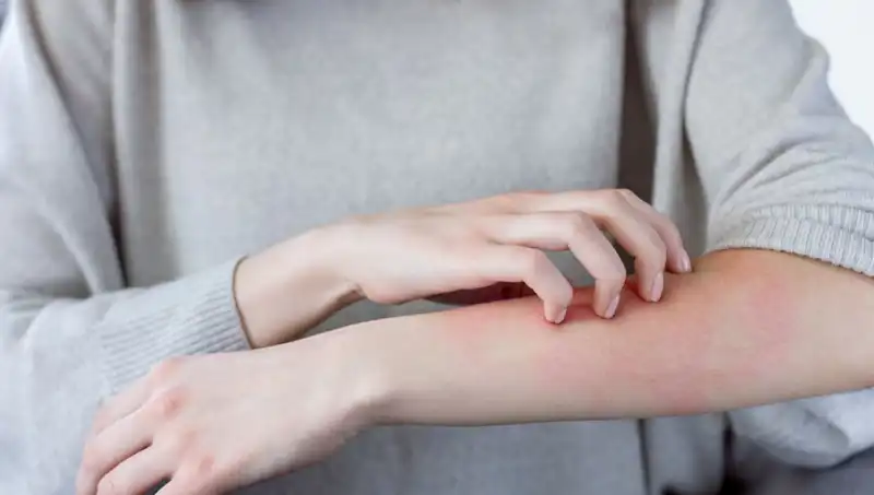 Cilt Kanseri Uyarısı: Dermatologdan Gözden Kaçırılan İki Belirti